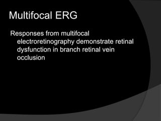 Multifocal ERG
Responses from multifocal
electroretinography demonstrate retinal
dysfunction in branch retinal vein
occlusion
 
