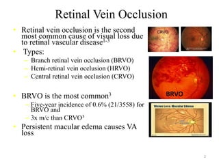 Retinal Vein Occlusion
• Retinal vein occlusion is the second
most common cause of visual loss due
to retinal vascular disease1-3
• Types:
– Branch retinal vein occlusion (BRVO)
– Hemi-retinal vein occlusion (HRVO)
– Central retinal vein occlusion (CRVO)
• BRVO is the most common3
– Five-year incidence of 0.6% (21/3558) for
BRVO and
– 3x m/c than CRVO3
• Persistent macular edema causes VA
loss
1. Yau et al. Intern Med J. 2008; 2. RCO RVO guidelines. 2009; 3. Klein et al. Trans Am Ophthalmol Soc. 2000.
HRVO
BRVO
2
 