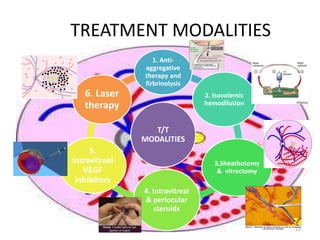 TREATMENT MODALITIES
T/T
MODALITIES
1. Anti-
aggregative
therapy and
firbrinolysis
2. Isovolemic
hemodilution
3.Sheathotomy
& vitrectomy
4. Intravitreal
& periocular
steroids
5.
Intravitreal
VEGF
inhibitors
6. Laser
therapy
22
 