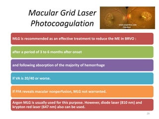 Macular Grid Laser
Photocoagulation
MLG is recommended as an effective treatment to reduce the ME in BRVO :
after a period of 3 to 6 months after onset
and following absorption of the majority of hemorrhage
if VA is 20/40 or worse.
If FFA reveals macular nonperfusion, MLG not warranted.
Argon MLG is usually used for this purpose. However, diode laser (810 nm) and
krypton red laser (647 nm) also can be used.
29
 