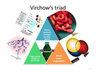 Virchow’s triad
Hemo-
dynamic
changes
(venous
stasis)
Degenerative
changes of
vessel wall
Blood
hyper-
coaguability
6
 