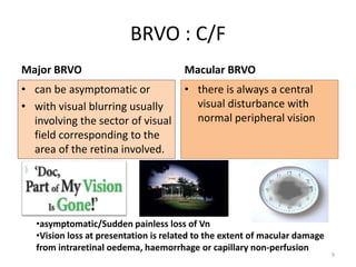 BRVO : C/F
Major BRVO
• can be asymptomatic or
• with visual blurring usually
involving the sector of visual
field corresponding to the
area of the retina involved.
Macular BRVO
• there is always a central
visual disturbance with
normal peripheral vision
•asymptomatic/Sudden painless loss of Vn
•Vision loss at presentation is related to the extent of macular damage
from intraretinal oedema, haemorrhage or capillary non-perfusion
9
 