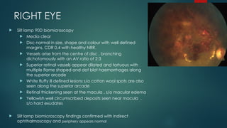 BRVO - Ophthalmology240122175846-e399bd47.pptx