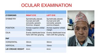 Case presentation on the topic BRVO.pptx
