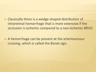  Classically there is a wedge-shaped distribution of
intraretinal hemorrhage that is more extensive if the
occlusion is ischemic compared to a non-ischemic BRVO.
 A hemorrhage can be present at the arteriovenous
crossing, which is called the Bonet sign.
 