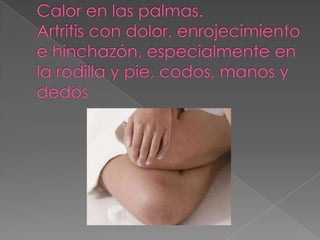 Calor en las palmas.Artritis con dolor, enrojecimiento e hinchazón, especialmente en la rodilla y pie, codos, manos y dedos