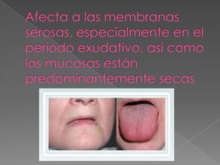 Afecta a las membranas serosas, especialmente en el período exudativo, así como las mucosas están predominantemente secas