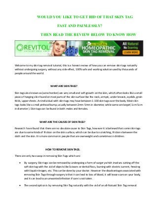 WOULD YOU LIKE TO GET RID OF THAT SKIN TAG
FAST AND PAINLESSLY?
THEN READ THE REVIEW BELOW TO KNOW HOW
Welcome to my skin tag removal tutorial, this is a honest review of how you can remove skin tags naturally
without undergoing surgery, without any side effect, 100% safe and working solution used by thousands of
people around the world.
WHAT ARE SKIN TAGS?
Skin tags also known as (acrochordon) are very small and soft growth on the skin, which often looks like a small
piece of hanging skin found on most parts of the skin surface like the neck, armpit, under breasts, eyelids, groin
folds, upper chests. An individual with skin tags may have between 1-100 skin tags over the body. Most skin
tags looks like a small pinhead bump, usually between 2mm-5mm in diameter, while some are larger( 1cm-5cm
in diameter ). Skin tags can be found in both males and females.
WHAT ARE THE CAUSES OF SKIN TAGS?
Research have found that there are no absolute cause to Skin Tags, however it is believed that some skin tags
are due to some kinds of friction on the skin surface, which can be due to scratching, frictions between the
cloth and the skin. It is more common in people that are overweight and sometimes in children.
HOW TO REMOVE SKIN TAGS.
There are only two ways in removing Skin Tags which are:
· By surgery; Skin tags can be removed by undergoing a form of surgery which involves cutting off the
soft skin tag with the aid of objects like Scissors or dental floss, burning with electric current, freezing
with liquid nitrogen, etc. This can be done by your doctor. However the disadvantages associated with
removing Skin Tags through surgery is that it can lead to loss of blood, it will leave scars on your body,
and it can lead to an unwanted infection if care is not taken.
· The second option is by removing Skin Tag naturally with the aid of an all-Natural Skin Tag removal
 