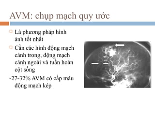 AVM: chụp mạch quy ước
 Là phương pháp hình
ảnh tốt nhất
 Cần các hình động mạch
cảnh trong, động mạch
cảnh ngoài và tuần hoàn
cột sống
-27-32% AVM có cấp máu
động mạch kép
 