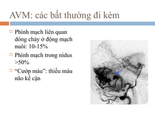 AVM: các bất thường đi kèm
 Phình mạch liên quan
dòng chảy ở động mạch
nuôi: 10-15%
 Phình mạch trong nidus
>50%
 “Cướp máu”: thiếu máu
não kế cận
 