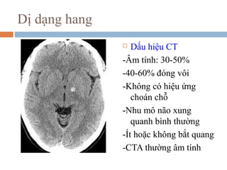 Dị dạng hang
 Dấu hiệu CT
-Âm tính: 30-50%
-40-60% đóng vôi
-Không có hiệu ứng
choán chỗ
-Nhu mô não xung
quanh bình thường
-Ít hoặc không bắt quang
-CTA thường âm tính
 