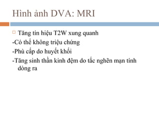  Tăng tín hiệu T2W xung quanh
-Có thể không triệu chứng
-Phù cấp do huyết khối
-Tăng sinh thần kinh đệm do tắc nghẽn mạn tính
dòng ra
Hình ảnh DVA: MRI
 