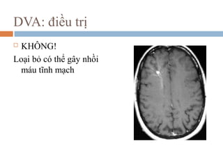 DVA: điều trị
 KHÔNG!
Loại bỏ có thể gây nhồi
máu tĩnh mạch
 