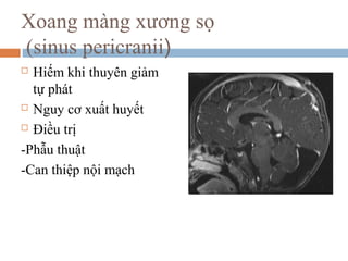  Hiếm khi thuyên giảm
tự phát
 Nguy cơ xuất huyết
 Điều trị
-Phẫu thuật
-Can thiệp nội mạch
Xoang màng xương sọ
(sinus pericranii)
 