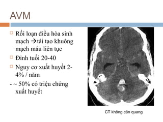 AVM
 Rối loạn điều hòa sinh
mạch tái tạo khuông
mạch máu liên tục
 Đỉnh tuổi 20-40
 Nguy cơ xuất huyết 2-
4% / năm
- ~ 50% có triệu chứng
xuất huyết
CT không cản quang
 
