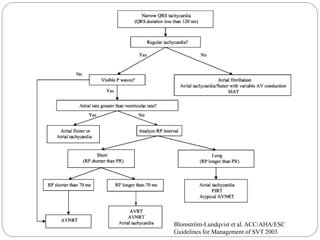 Blomström-Lundqvist et al. ACC/AHA/ESC
Guidelines for Management of SVT 2003
 