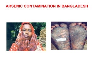 ARSENIC CONTAMINATION IN BANGLADESH
 