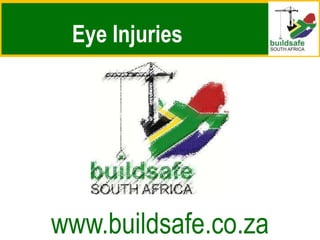 Eye Injuries
www.buildsafe.co.za
 