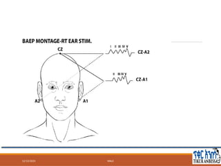 Brainstem auditory evoked potentials BSAEP (1).pptx