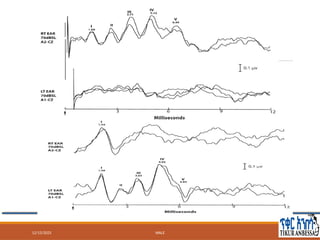 Brainstem auditory evoked potentials BSAEP (1).pptx