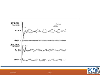 Brainstem auditory evoked potentials BSAEP (1).pptx