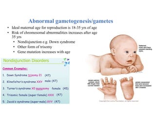 Abnormal gametogenesis/gametes
• Ideal maternal age for reproduction is 18-35 yrs of age
• Risk of chromosomal abnormalities increases after age
35 yrs
• Nondisjunction e.g. Down syndrome
• Other form of trisomy
• Gene mutation increases with age
 