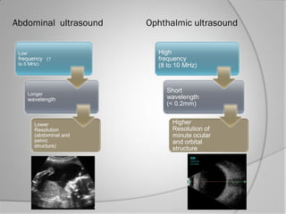 Low
frequency (1
to 5 MHz)
Longer
wavelength
Lower
Resolution
(abdominal and
pelvic
structure)
Abdominal ultrasound Ophtha...