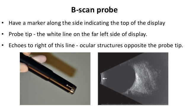 B scan