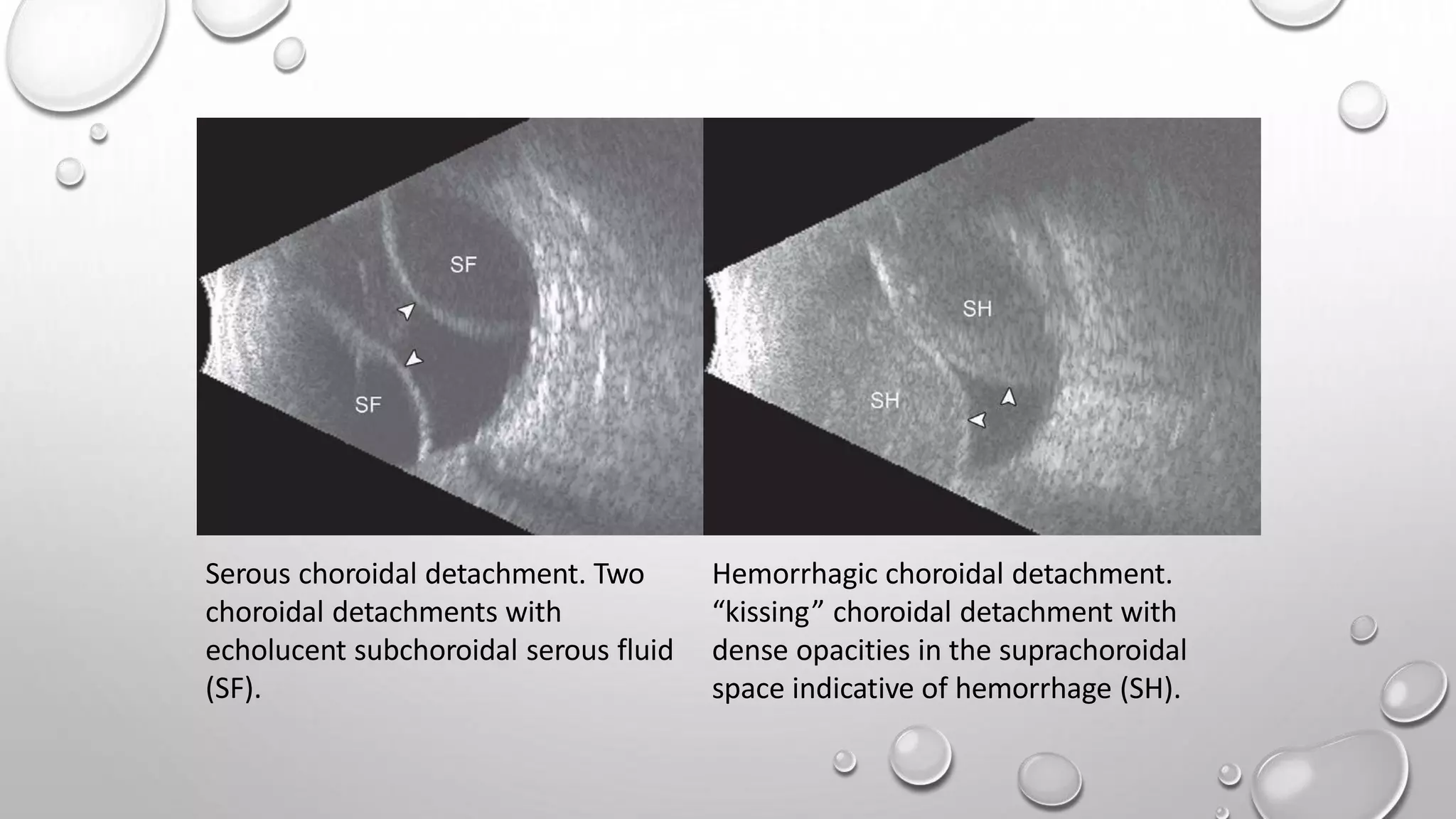 Understanding What Is Biological Substrate And Its Critical Role