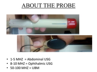 ABOUT THE PROBE 
• 1-5 MHZ = Abdominal USG 
• 8-10 MHZ = Ophthalmic USG 
• 50-100 MHZ = UBM 
 