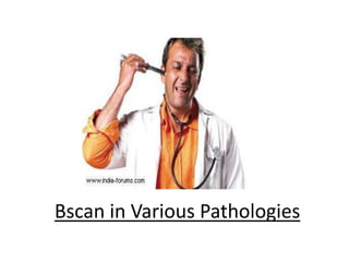Bscan in Various Pathologies 
 