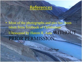 References 
• Most of the photographs and pics hav been 
taken from Textbook of Ophthalmic 
Ultrasound by Hatem R. Aata WITHOUT 
PRIOR PERMISSION. 
 