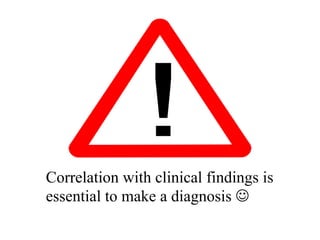 Correlation with clinical findings is 
essential to make a diagnosis  
 