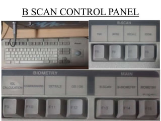 B SCAN CONTROL PANEL 
 