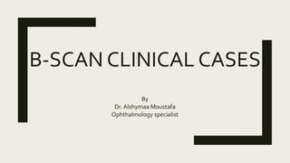 B-SCAN CLINICAL CASES
By
Dr. Alshymaa Moustafa
Ophthalmology specialist
 