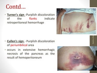 Contd…
• Turner's sign -Purplish discoloration
of the flanks indicate
retroperitoneal hemorrhage
• Cullen's sign - Purplish discoloration
of periumbilical area
• occurs in extensive hemorrhagic
necrosis of the pancreas as the
result of hemoperitoneum
10/4/2023
Neelima
Shakya
18
 