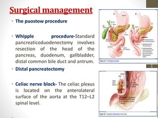 Surgical management
• The puostow procedure
• Whipple procedure-Standard
pancreaticoduodenectomy involves
resection of the head of the
pancreas, duodenum, gallbladder,
distal common bile duct and antrum.
• Distal pancreatectomy
• Celiac nerve block- The celiac plexus
is located on the anterolateral
surface of the aorta at the T12–L2
spinal level.
10/4/2023
Neelima
Shakya
48
 