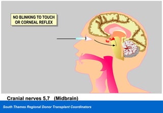 Brain Stem Death Testing | PPT