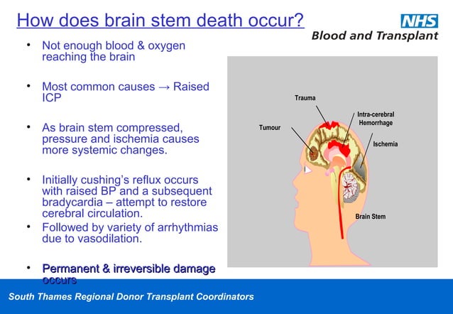 Brain Stem Death Testing And Organ Donation Ppt