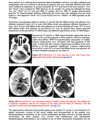 these patients were suffering from moderate clinical disabilities and they were fully ambulant and
independent, that is in contrast to all group (2) patients who were markedly disabled and wheel
chair confined on admission. In group (3) patients all "CT scan focal brain stem tumours" were
also "focal" when examined by MRI. However in case number 14, group (2), although the lesion
was seen "focal" by CT scan and MRI T1 images, however MRI T2 images demonstrated
punctate T2 hyperintensities diffusely infiltrating the brain stem and radiating from the focal
lesion i.e. what appeared "focal" on CT scan turned out to be "diffuse" on MRI especially on the
T2 images.

Precontrast neuroimaging studies in group 1,2 showed that the diffuse brain stem gliomas were
diffusely isodense(2 cases, 14% of cases with diffuse brain stem gliomas), diffusely hypodense (2
cases, 14% of cases with diffuse brain stem gliomas) or of mixed densities (10 cases, 72% of cases
with diffuse brain stem gliomas) on precontrast CT scan. In general these lesions appeared
hypointense on the precontrast T1 MRI images and diffusely hyperintense on the T2 MRI images.

                            Precontrast CT density or MRI signal intensities apparently had no
                            effect on the overall prognosis in those patients. However punctate,
                            rather than diffuse, MRI T2 hyperintensities and patchy or ringlike
                            contrast enhancement were correlated with bad prognosis in this
                            study. It looks like that contrast enhancement in diffuse brain stem
                            glioma is of bad prognostic significance. Contrast enhancement
                            occurred in 3 cases (21% of cases with diffuse brain stem gliomas), all
                            of which belonged to group (2). See table 1,2

                            Figure [9] Postcontrast CT scan showing a case with brain stem
                            glioma and with patchy enhancement (group 2)




Figure [10] Precontrast CT scan showing examples of diffuse brain stem gliomas. The middle one
is diffusely hypodense and the two images on the right and left sides are isodense. The 4th
ventricle is compressed and displaced posteriorly. (Group 1,2)

The single patient with focal cystic pontine glioma (case number 17, group 3 ) was treated by CT
guided stereotaxic excision of the mural nodule and decompression of the pontine cyst.
Histopathological examination of the excised pathological specimen showed a juvenile pilocytic
astrocytoma. All other patients were treated with radiotherapy and subsequently
histopathological confirmation is not available in any of them. Postmortem examination was not
 