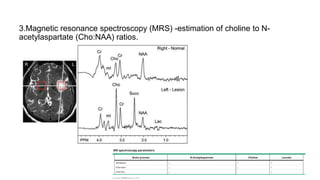 3.Magnetic resonance spectroscopy (MRS) -estimation of choline to N-
acetylaspartate (Cho:NAA) ratios.
 