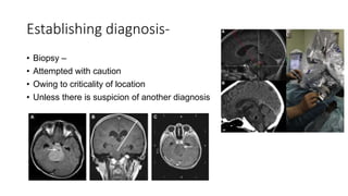 Establishing diagnosis-
• Biopsy –
• Attempted with caution
• Owing to criticality of location
• Unless there is suspicion of another diagnosis
 