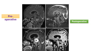 Pre-
operative
Postoperative
 
