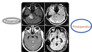 Preoperative
Postoperative
 