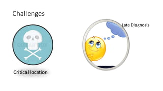 Challenges
Critical location
Late Diagnosis
 