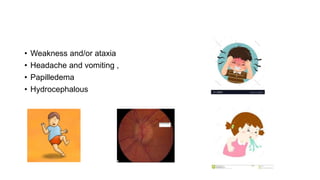 • Weakness and/or ataxia
• Headache and vomiting ,
• Papilledema
• Hydrocephalous
 