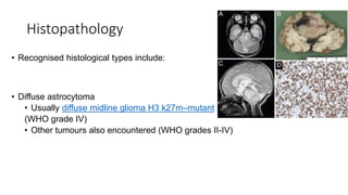 Histopathology
• Recognised histological types include:
• Diffuse astrocytoma
• Usually diffuse midline glioma H3 k27m–mutant
(WHO grade IV)
• Other tumours also encountered (WHO grades II-IV)
 
