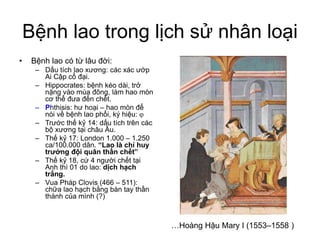 Bệnh lao trong lịch sử nhân loại
• Bệnh lao có từ lâu đời:
– Dấu tích lao xương: các xác ướp
Ai Cập cổ đại.
– Hippocrates: bệnh kéo dài, trở
nặng vào mùa đông, làm hao mòn
cơ thể đưa đến chết.
– Phthisis: hư hoại – hao mòn để
nói về bệnh lao phổi, ký hiệu: 
– Trước thế kỷ 14: dấu tích trên các
bộ xương tại châu Âu.
– Thế kỷ 17: London 1.000 – 1.250
ca/100.000 dân. “Lao là chỉ huy
trưởng đội quân thần chết”
– Thế kỷ 18, cứ 4 người chết tại
Anh thì 01 do lao: dịch hạch
trắng.
– Vua Pháp Clovis (466 – 511):
chữa lao hạch bằng bàn tay thần
thánh của mình (?)
…Hoàng Hậu Mary I (1553–1558 )
 