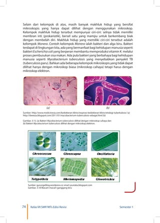 74 Kelas VII SMP/MTs Edisi Revisi Semester 1
(a) (b)
Sumber: http://www.medicinesia.com/kedokteran-klinis/respirasi-kedokteran-klinis/etiologi-tuberkulosis/ (a)
http://dweeza.blogspot.com/2011/01/mycobacterium-tuberculosis-sebagai.html (b)
Gambar. 3.15. (a) Bakteri Mycobacterium tuberculosis dilihat dengan mikroskop cahaya dan
(b) Bakteri Mycobacterium tuberculosis dilihat dengan mikroskop elektron.
Sumber :gurungeblog.wordpress.co smart-pustaka.blogspot.com
Gambar. 3.18 Macam-macam ganggang biru
Selain dari kelompok di atas, masih banyak makhluk hidup yang bersifat
mikroskopis yang hanya dapat dilihat dengan menggunakan mikroskop.
Kelompok makhluk hidup tersebut mempunyai ciri-ciri: selnya tidak memiliki
membran inti (prokariotik), bersel satu yang mampu untuk berkembang biak
dengan membelah diri. Makhluk hidup yang memiliki ciri-ciri tersebut adalah
kelompok Monera. Contoh kelompok Monera ialah bakteri dan alga biru. Bakteri
terdapat di lingkungan kita, ada yang bermanfaat bagi kehidupan manusia seperti
bakteri Escherichia coli yang berperan membantu memproduksi vitamin K melalui
proses pembusukan sisa makan. Ada pula bakteri yang berbahaya bagi kehidupan
manusia seperti Mycobacterium tuberculosis yang menyebabkan penyakit TB
(tuberculosis paru). Bahkan ada beberapa kelompok mikroskopis yang tidak dapat
dilihat hanya dengan mikroskop biasa (mikroskop cahaya) tetapi harus dengan
mikroskop elektron.
 