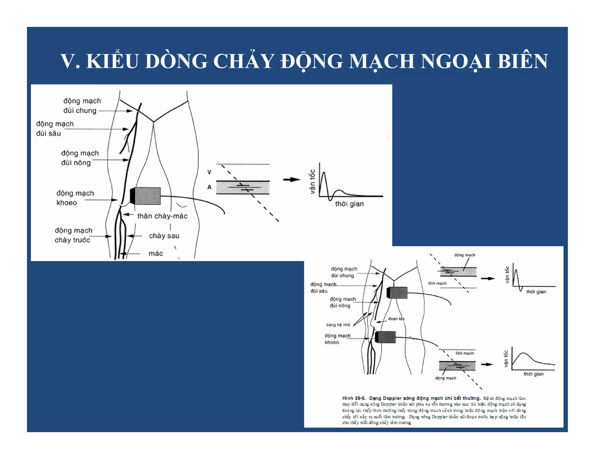 Siêu âm Doppler động mạch ngoại biên | PDF